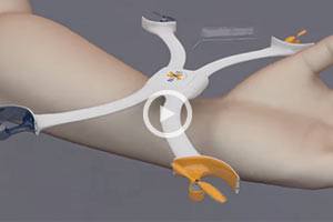 Nixie – The First Wearable Camera That Can Fly