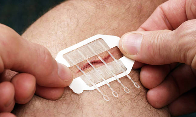 ZipStitch Will Save You a Trip to the Hospital for Stitches